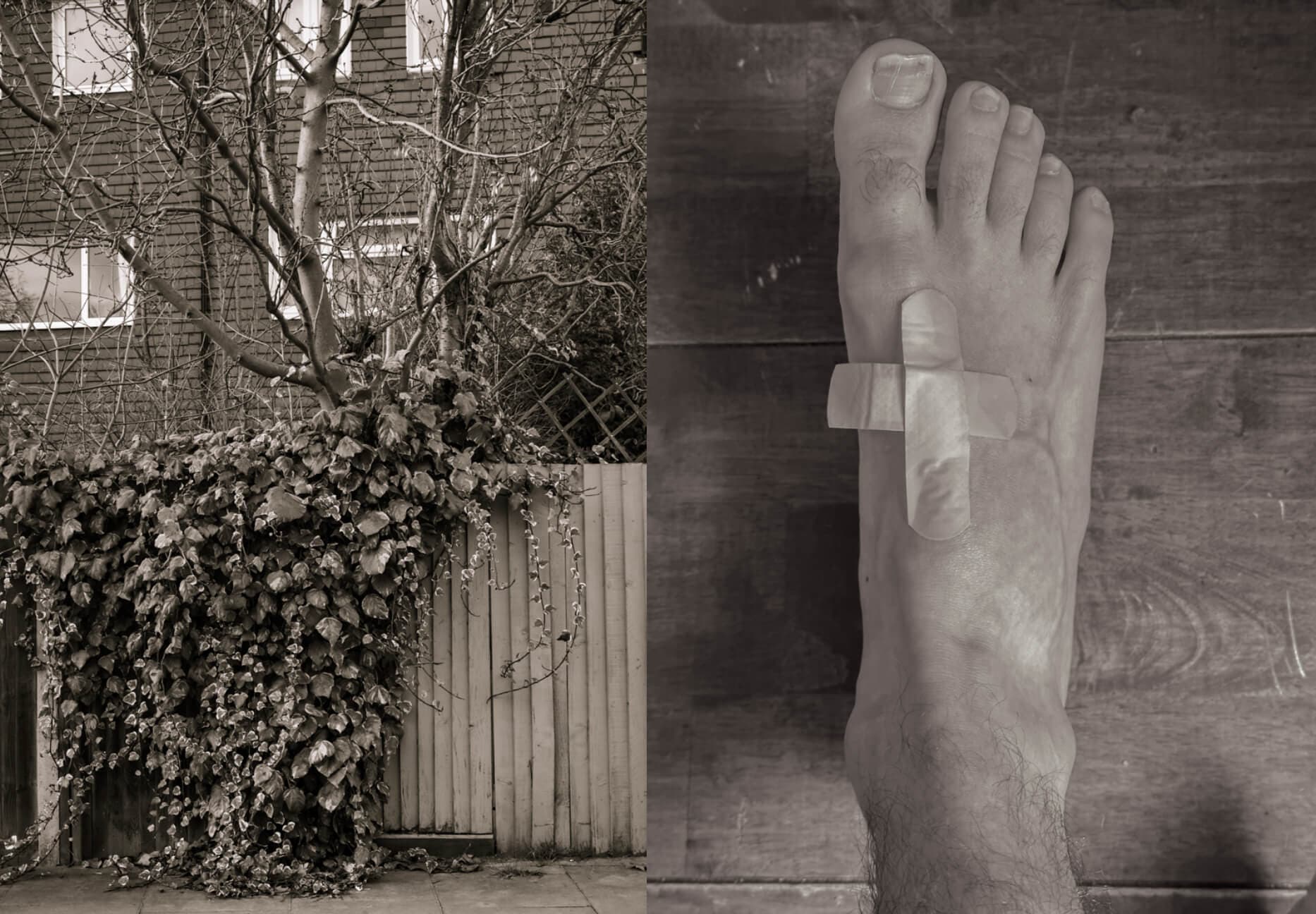 Fence and tree in sepia tones and foot with plasters forming a cross in sepia tones